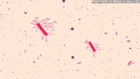 Bacillus cereus characteristics image