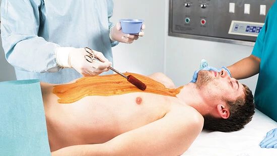 Healthcare professional applies antiseptic to a patient's chest on an operating table; face blurred, medical equipment in background.